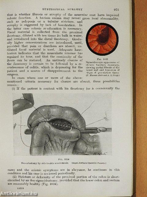 Surgery of Modern Warfare VI. (töredék)