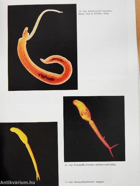 Trópusi betegségek