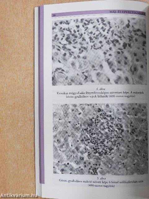 Máj- és epebetegségek