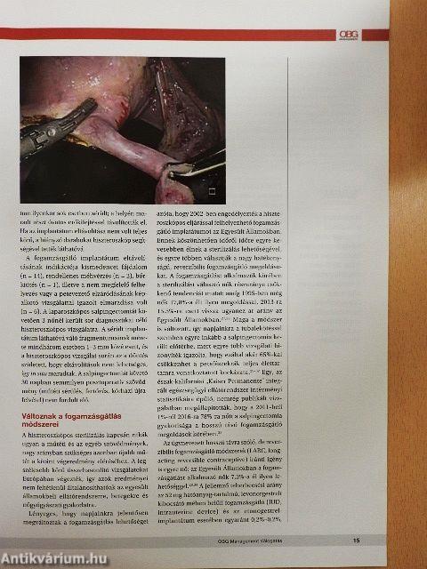 OBG Management válogatás 2017. november