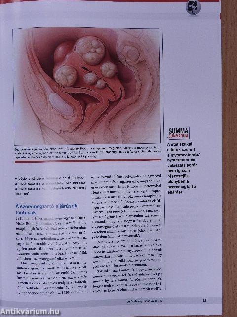 OBG Management válogatás 2017. március