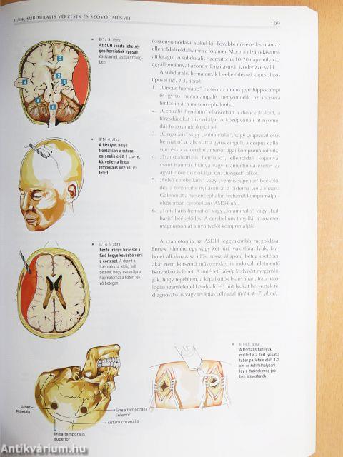 A neurotraumatológia alapvonalai