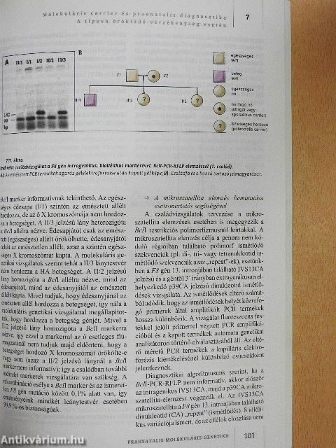 Praenatalis molekuláris genetika