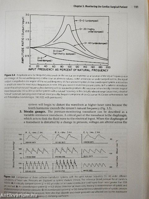 A Practical Approach to Cardiac Anesthesia