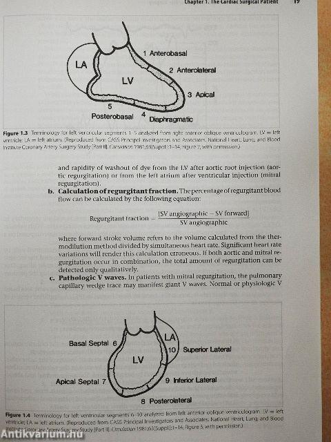 A Practical Approach to Cardiac Anesthesia