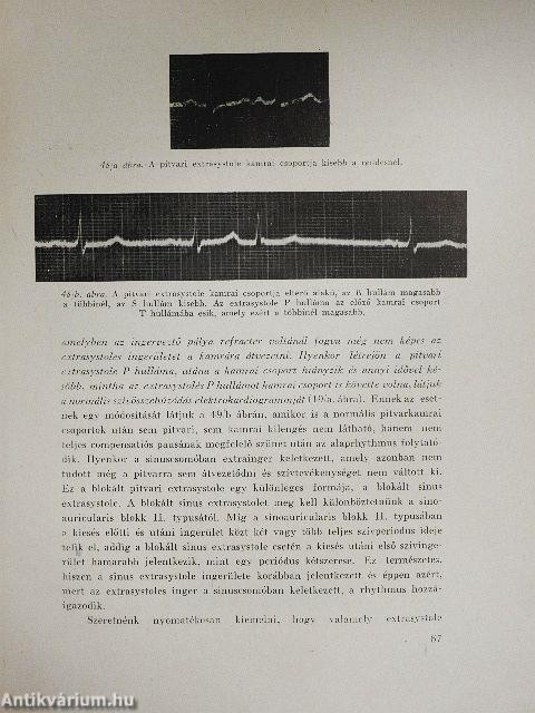 Gyakorlati elektrokardiographia I.