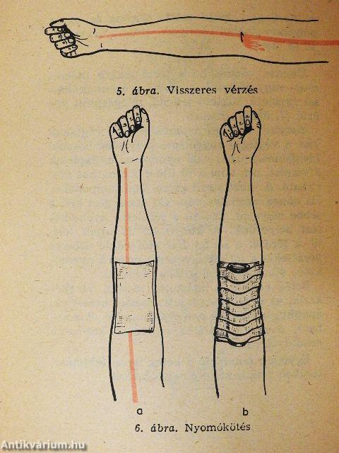 Elsősegélynyújtás