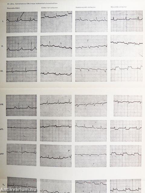 Rövid belgyógyászat