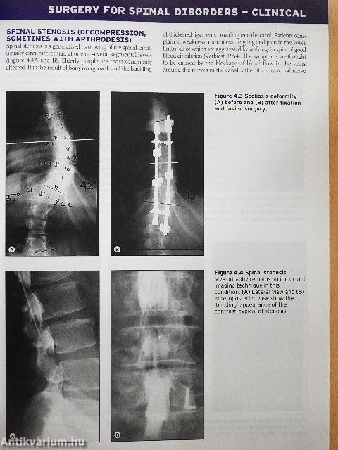 Orthopaedic Physiotherapy