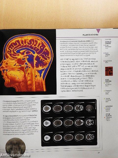 Megmagyarázzuk az emberi értelmet