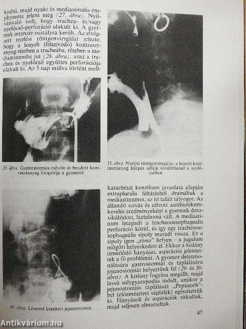 A lézerek klinikai alkalmazása