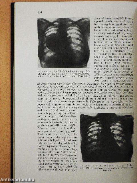 A lymphogranulomatosis kór- és gyógytana