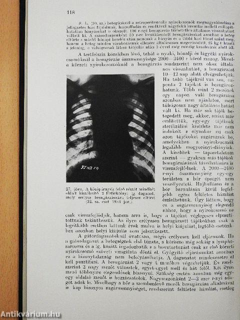 A lymphogranulomatosis kór- és gyógytana