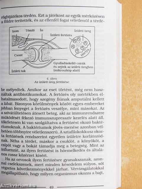 Hogyan orvosoljuk reumánkat és ízületi fájdalmainkat