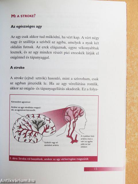 Hogyan kerüljük el a szívrohamot és a szélütést?
