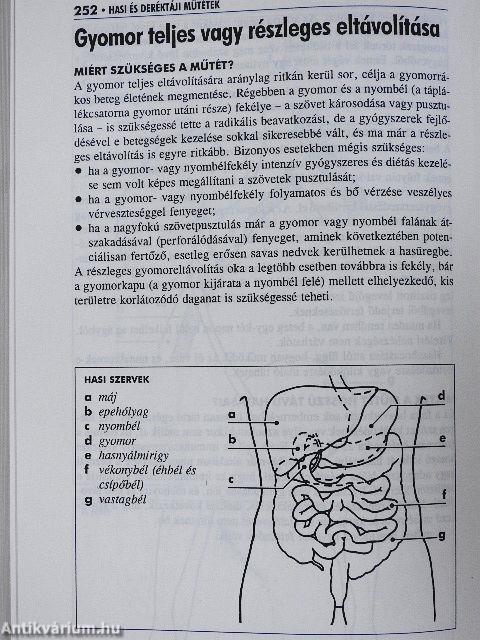 Műtét előtt, alatt és után