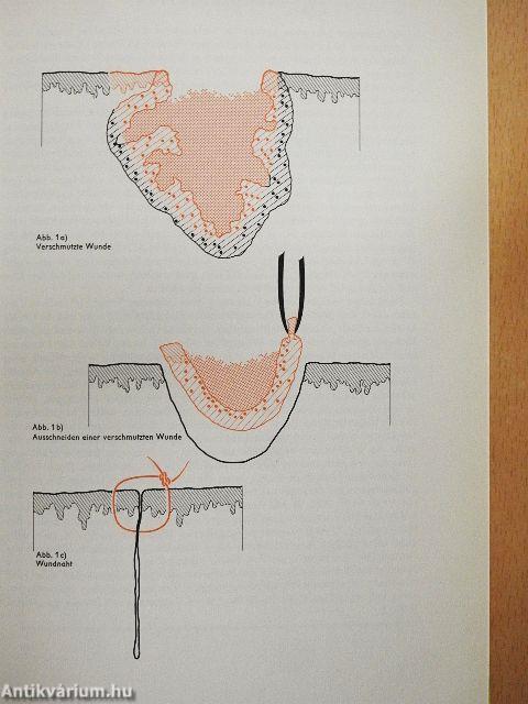 Wie funktioniert das? - Der Mensch und seine Krankheiten