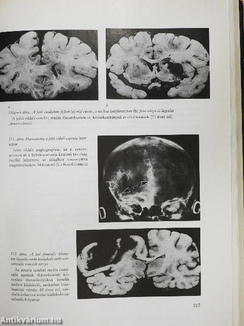 A klinikai neurologia alapjai