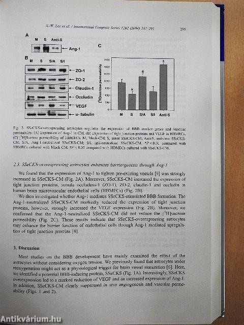 Atherosclerosis XIII