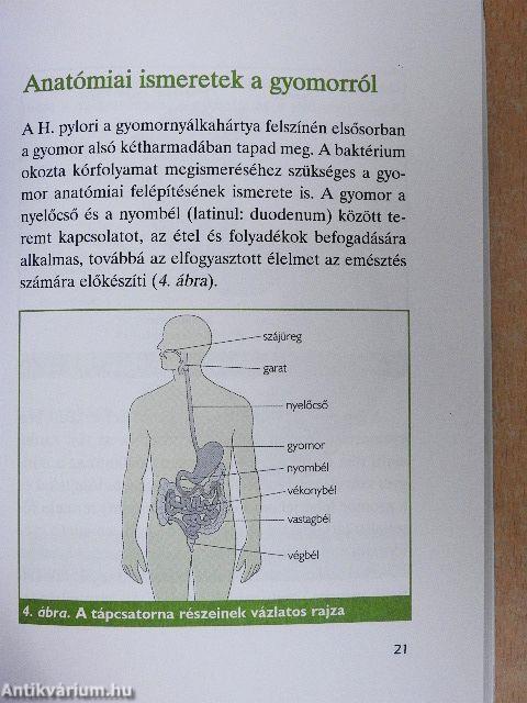 A fekélybetegség és a Helicobacter pylori-fertőzöttség