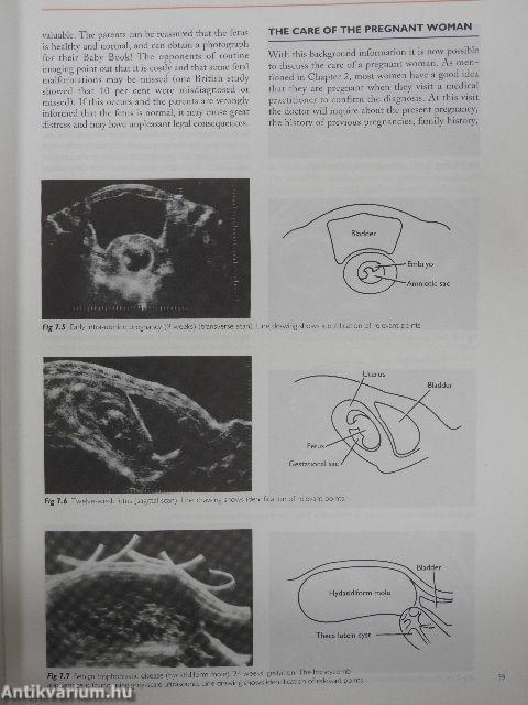 Fundamentals of Obstetrics and Gynaecology