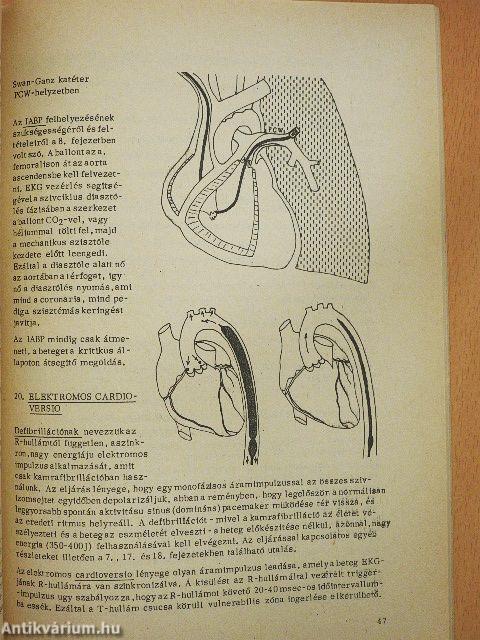 Betegellátás coronari-őrzőben