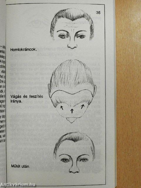 Modern szépségsebészet