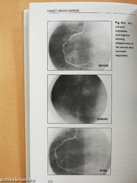 Cardiovascular Risk Factors