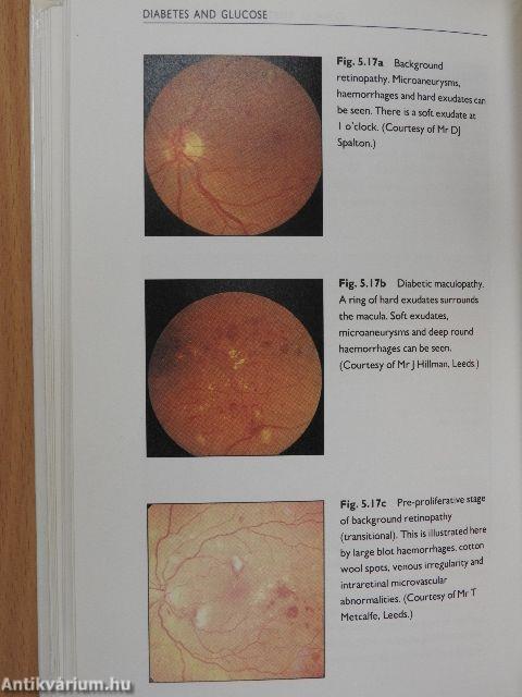 Cardiovascular Risk Factors