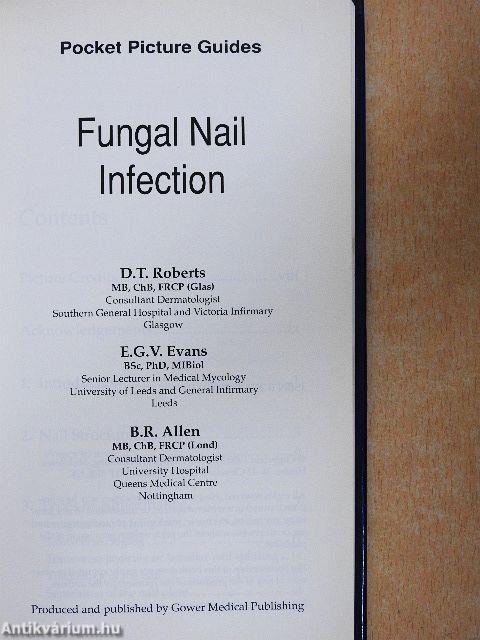 Fungal Nail Infection