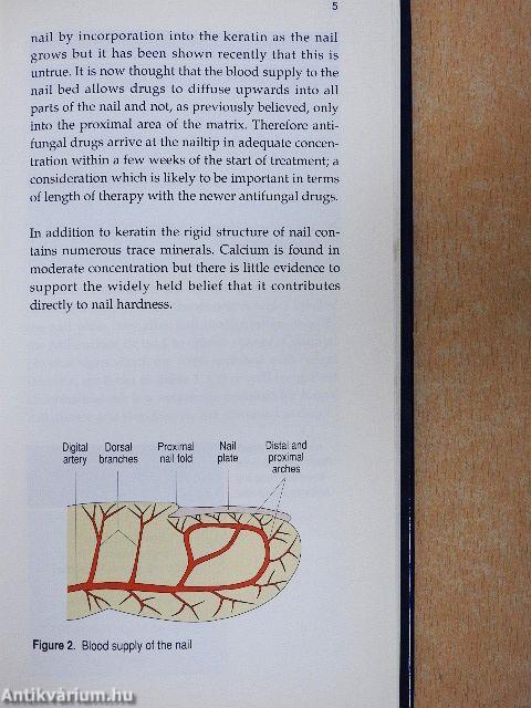 Fungal Nail Infection