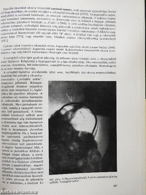 Belbetegségek elkülönítő diagnosisa