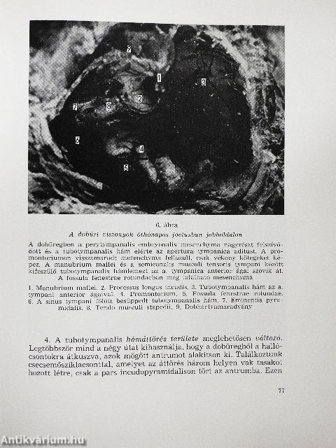 Localis antisepsis a fül-orr-gégészetben