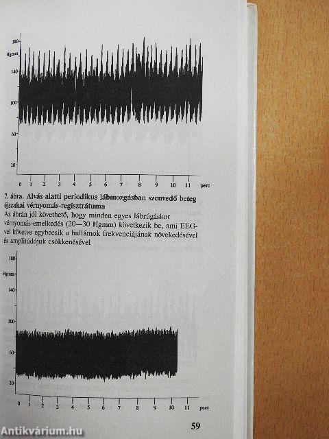 Légzészavarok alvás alatt