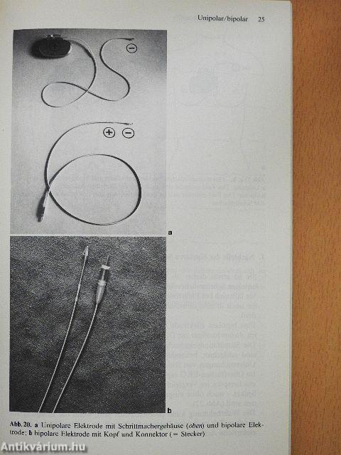 Praxis der Herzschrittmachertherapie