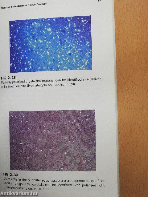 Illustrated Handbook of Drug Abuse