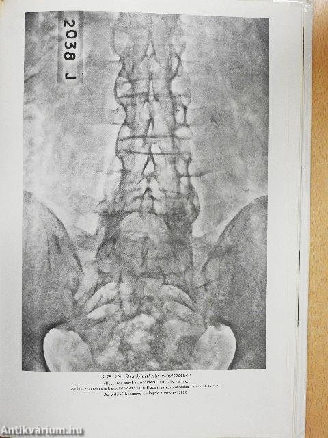 Klinikai röntgendiagnosztika