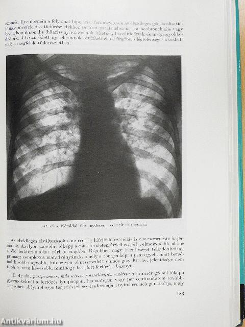 A radiologia alapvonalai