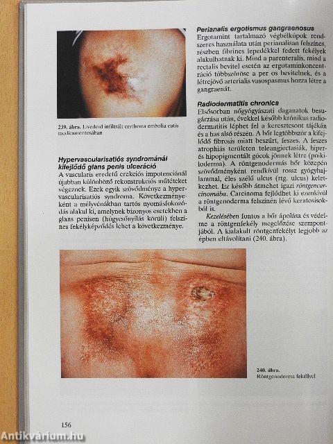 A genitoanalis tájék bőrbetegségei