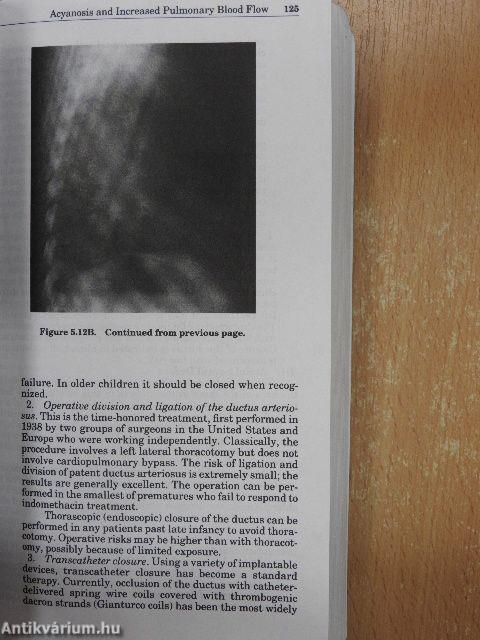 Pediatric Cardiology