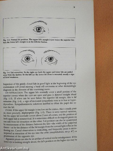 Ophthalmology