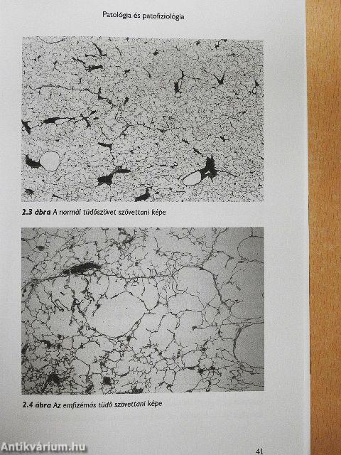 COPD az alapellátásban
