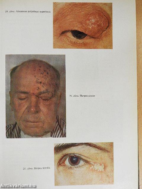 A szemészet alapvonalai