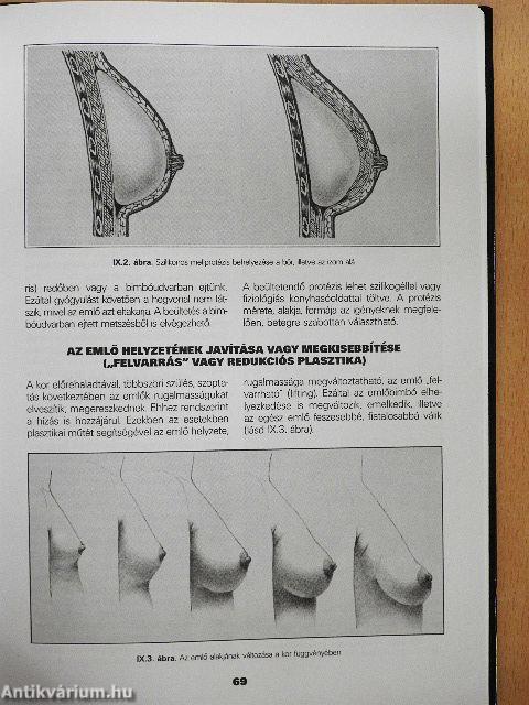 Hétköznapi ismeretek az emlőről és betegségeiről