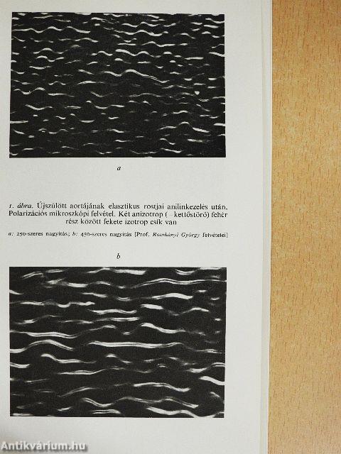 Elasztin és elasztáz az atherosclerosis-kutatásban