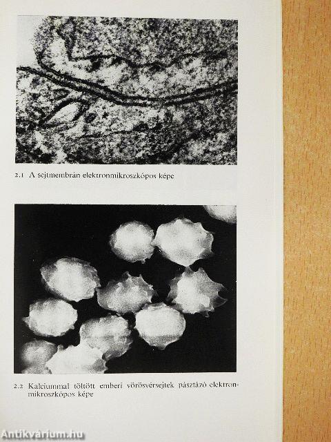 Membránok és membránbetegségek