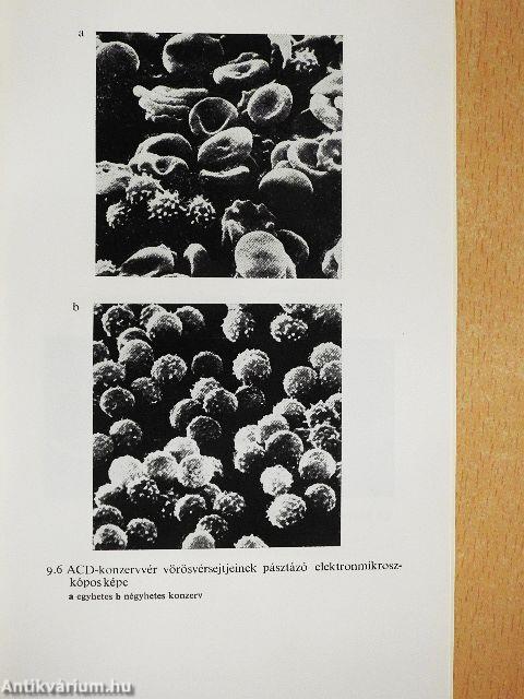 Membránok és membránbetegségek