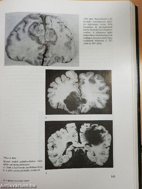 A klinikai neurologia alapjai