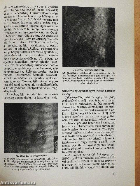 A máj, az epeutak és a hasnyálmirigy betegségei