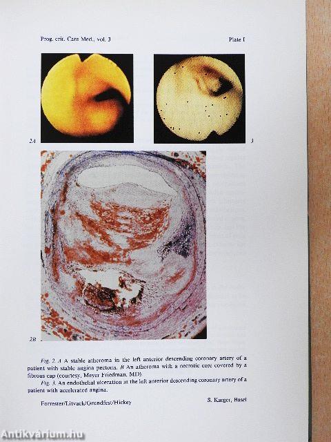 Critical Care Cardiology